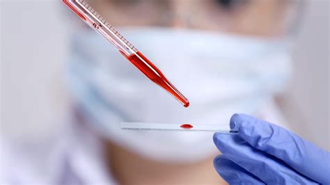 Blood Test Codes: 11 Common Abbreviations Explained.